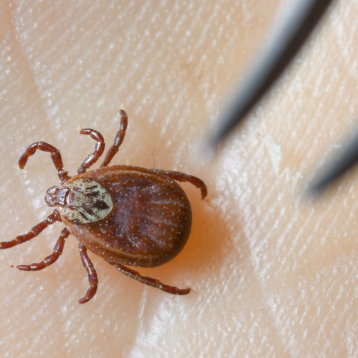 Zecken sind inzwischen ganzjährig aktiv, sie erobern selbst kühle Berglagen und verbreiten das FSME-Virus in ganz Deutschland.(Symboldbild)  - Foto: Patrick Pleul/dpa-Zentralbild/dpa