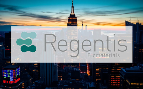 Regentis Aktie: Finanzielle Unsicherheit - Foto: über boerse-global.de
