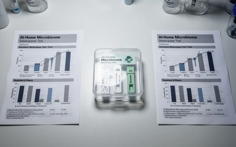 Mikrobiom-Heimtests: Neue Studie offenbart gravierende Mängel - Foto: über boerse-global.de