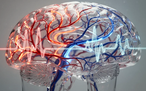 AHA/ASA stellen neue Schlaganfall-Leitlinien vor - Foto: über boerse-global.de