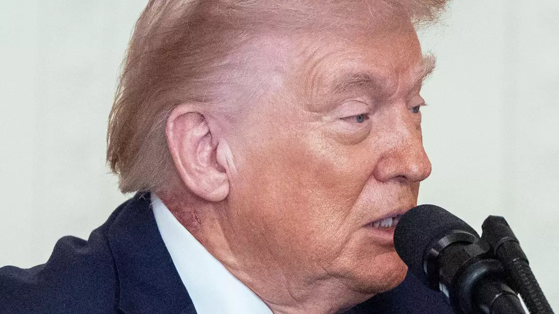 Eine Stelle an Trumps Hals hat eine Welle von Spekulationen über die Gesundheit des Präsidenten ausgelöst. - Bild: Alex Brandon/AP/dpa