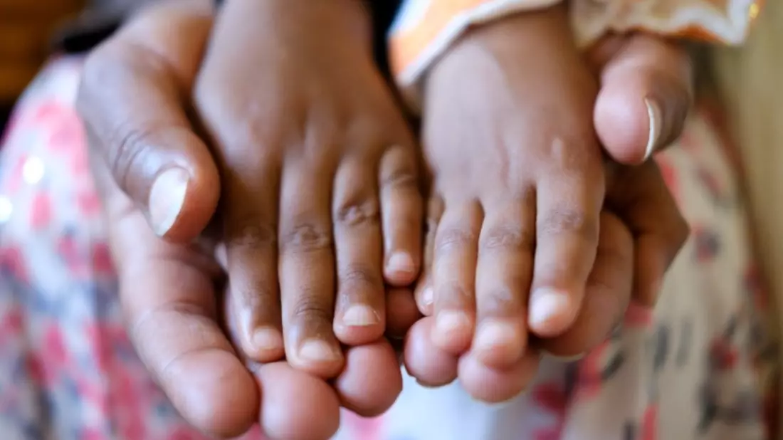 Uns steht eine neue Aids-Epidemie bevor: Der Stopp der US-Entwicklungshilfe torpediert die Aidsbekämpfung in Nigeria und Simbabwe / (Serie: Der Wegfall von USAID und seine Folgen, Teil 3) - Bild: presseportal.de