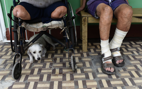 Das erste leprafreie Land auf dem amerikanischen Kontinent: Chile. (Archivbild) - Foto: Fabio Teixeira/dpa