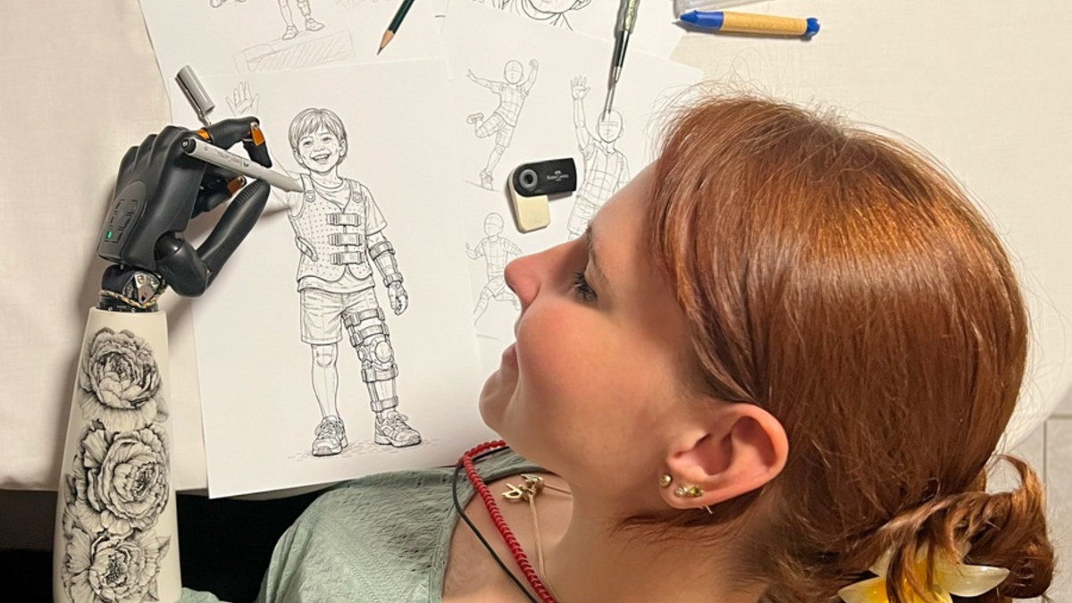 OTWorld: Starke Stimme für die Hilfsmittelversorgung / Eigenständigkeit, Engagement und Forschung: Lara Wilkin und ihr Weg mit moderner Armprothetik - Foto: presseportal.de