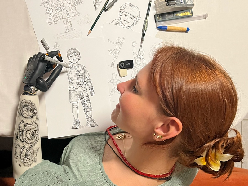 OTWorld: Starke Stimme für die Hilfsmittelversorgung / Eigenständigkeit, Engagement und Forschung: Lara Wilkin und ihr Weg mit moderner Armprothetik - Foto: presseportal.de