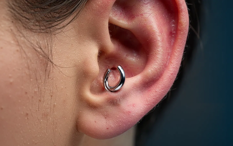 Anti-Migräne-Piercing: Medizin warnt vor riskanter Trend-Behandlung - Foto: über boerse-global.de