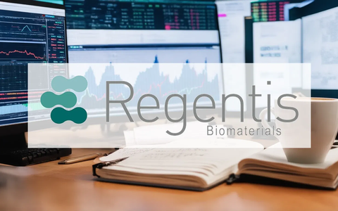 Regentis Aktie: Effizienz-Sprung gelungen - Foto: über boerse-global.de
