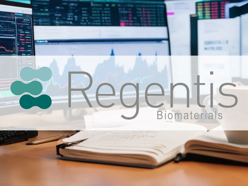 Regentis Aktie: Effizienz-Sprung gelungen - Foto: über boerse-global.de