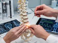 Akupunktur wird Mainstream: Schmerztherapie im Umbruch - Foto: über boerse-global.de