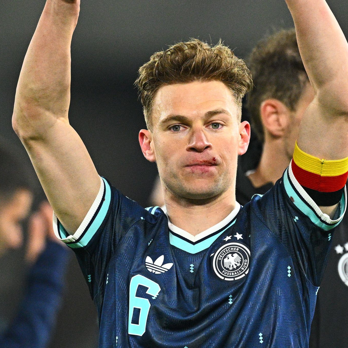 Joshua Kimmich feiert mit einer Verletzung an der Lippe den Sieg in der Schweiz.  - Foto: Tom Weller/dpa