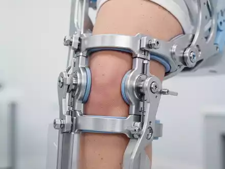 Knorpel-Regeneration: Neue Therapien ersetzen künstliche Kniegelenke - Foto: über boerse-global.de