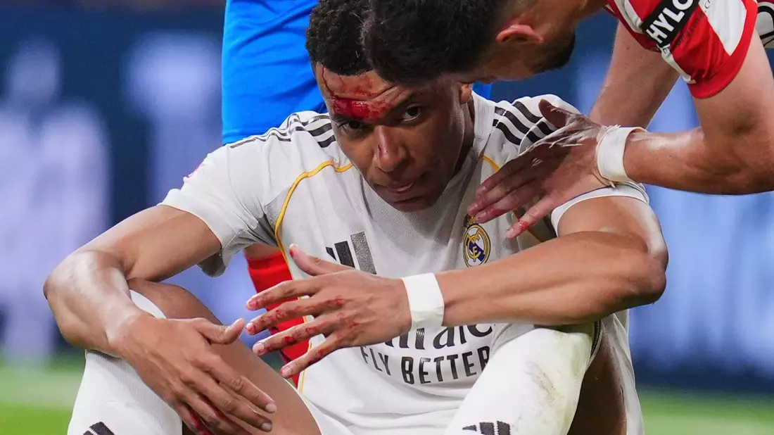 Kopfwunde bei Reals Generalpobe: Aber Kylian Mbappé kann in München wohl auflaufen. (Archivbild) - Bild: Manu Fernandez/AP/dpa