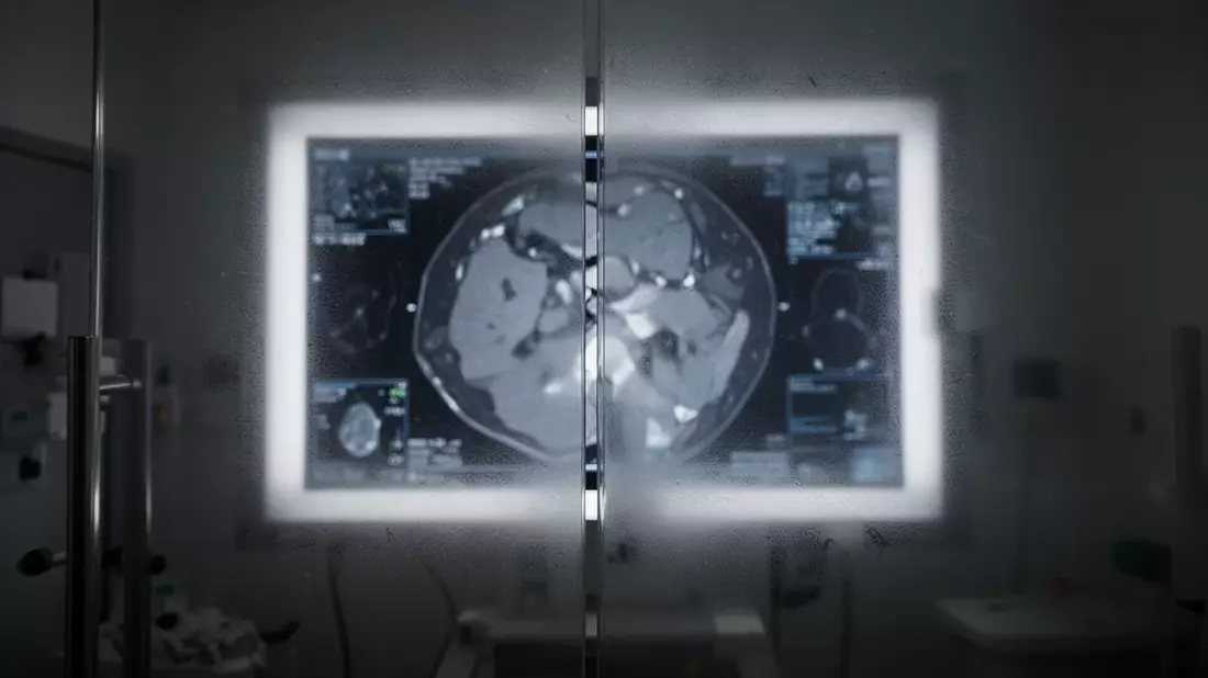 Medical Imaging Aktie: Transparenz-Krise - Bild: über boerse-global.de