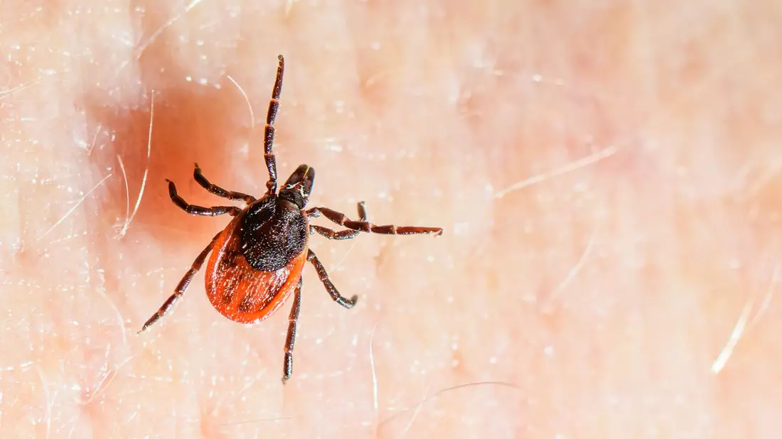 Der Gemeine Holzbock ist die häufigste Zeckenart in Deutschland und auch die, die hauptsächlich FSME und Borreliose auf den Menschen übertragt. (Archivbild) - Bild: Patrick Pleul/dpa