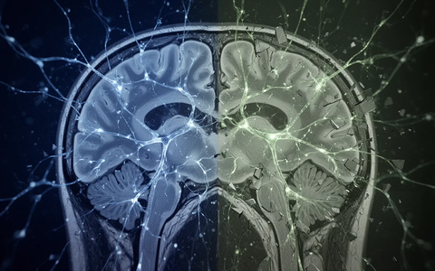 Alzheimer-Erkrankung: Forscher entdecken drei Verlaufsformen - Foto: über boerse-global.de