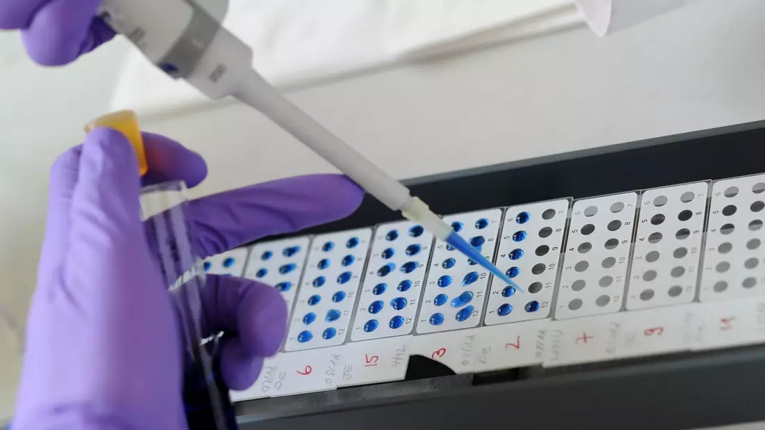 Am Bernhard-Nocht-Institut für Tropenmedizin (BNI) werden Viren aus aller Welt - darunter auch Hantaviren - erforscht. - Bild: Angelika Warmuth/dpa