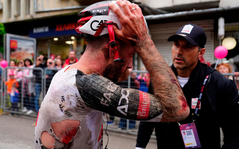 Mitfavorit Adam Yates stürzte beim Giro d'Italia schwer. - Foto: Fabio Ferrari/LaPresse/AP/dpa