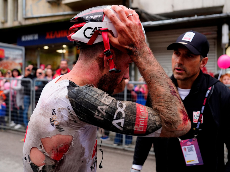 Mitfavorit Adam Yates stürzte beim Giro d'Italia schwer. - Foto: Fabio Ferrari/LaPresse/AP/dpa