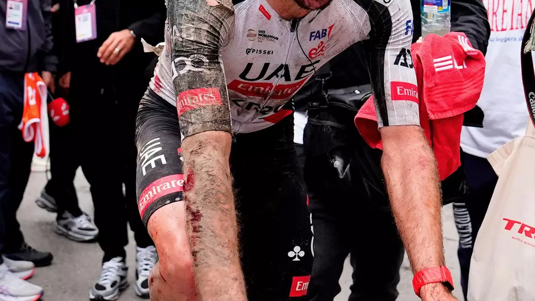 Trotz seines schweren Sturzes fuhr Adam Yates zunächst weiter. - Bild: Fabio Ferrari/LaPresse/AP/dpa