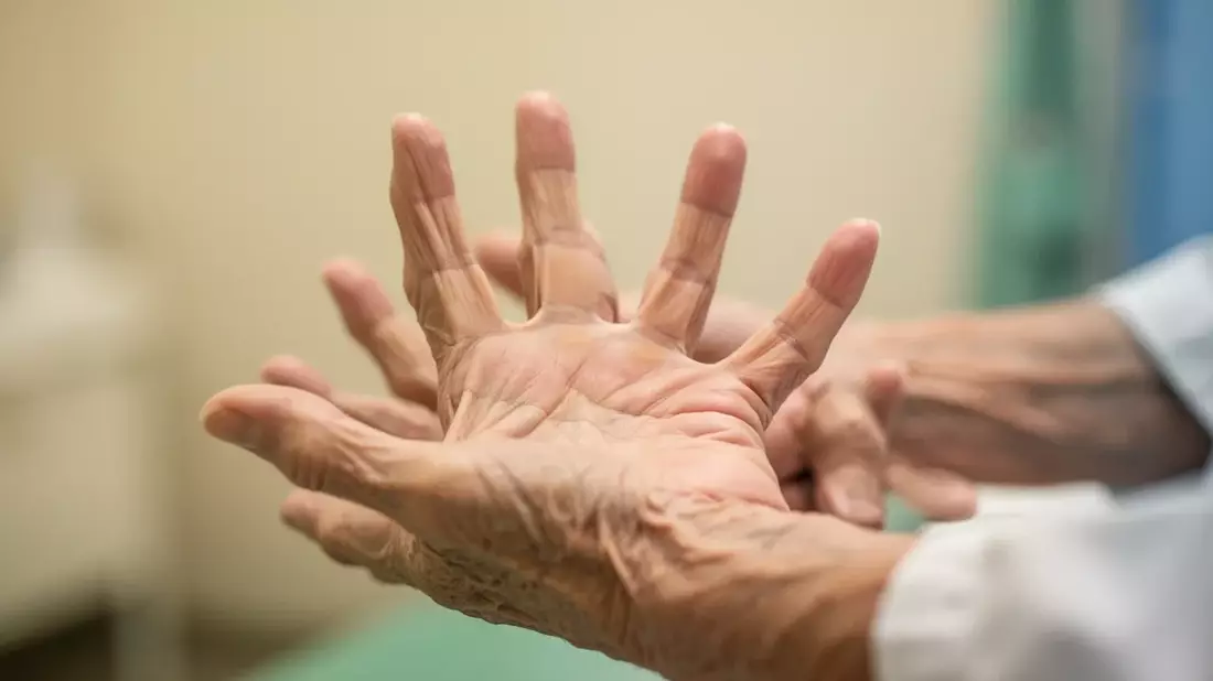 Bewegung statt Schonung: Moderne Handtherapie setzt auf KI und Training - Bild: über boerse-global.de
