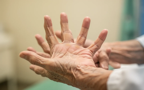 Bewegung statt Schonung: Moderne Handtherapie setzt auf KI und Training - Foto: über boerse-global.de