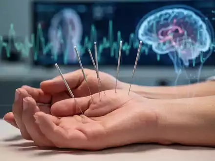 Akupunkturnadeln in der Hand eines Patienten mit verschwommenem medizinischem Hintergrund, der Präzision und Therapie symbolisiert. - Foto: über boerse-global.de