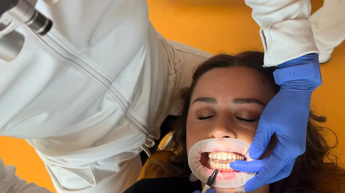 Innovation in der Zahnästhetik: KU64 stellt substanzschonende Flowable Injection Technique vor - Bild: presseportal.de