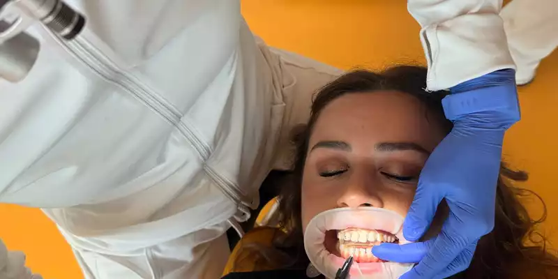 Innovation in der Zahnästhetik: KU64 stellt substanzschonende Flowable Injection Technique vor - Foto: presseportal.de