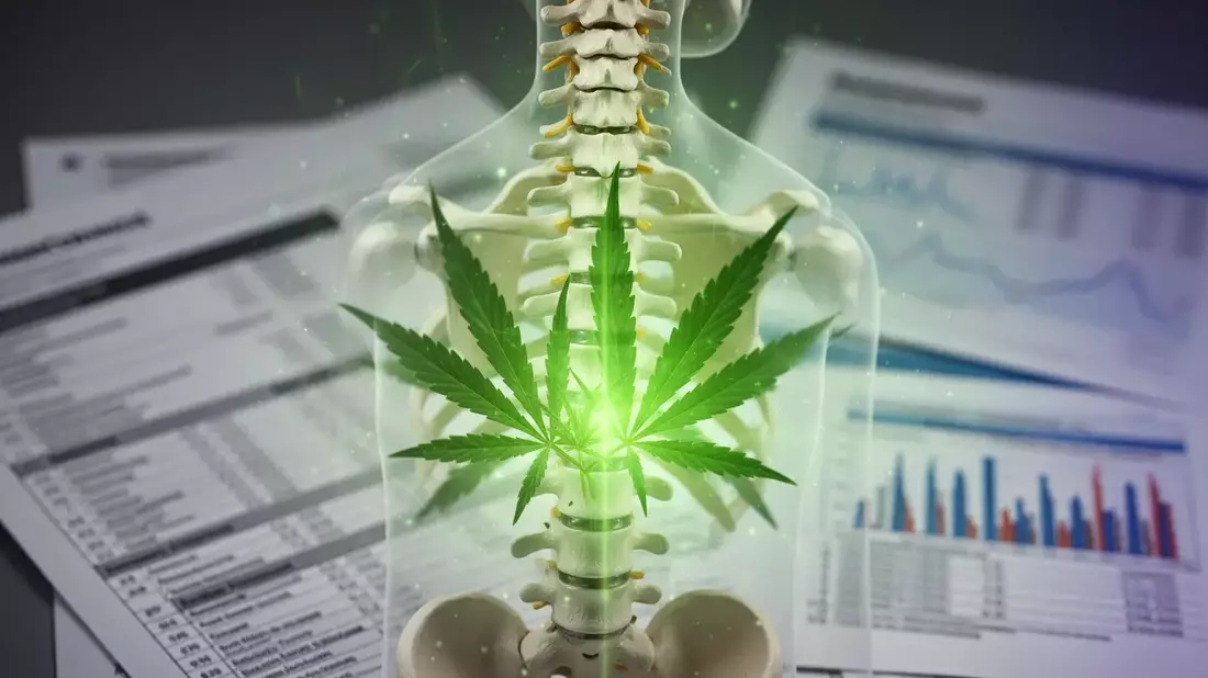 Vertanical erhält Zulassung: Cannabis-Medikament gegen Rückenschmerzen