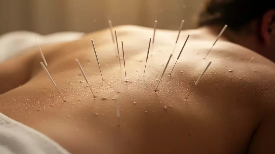 Neue Akupunktur-Therapie für Fibromyalgie-Patienten in Nürnberg