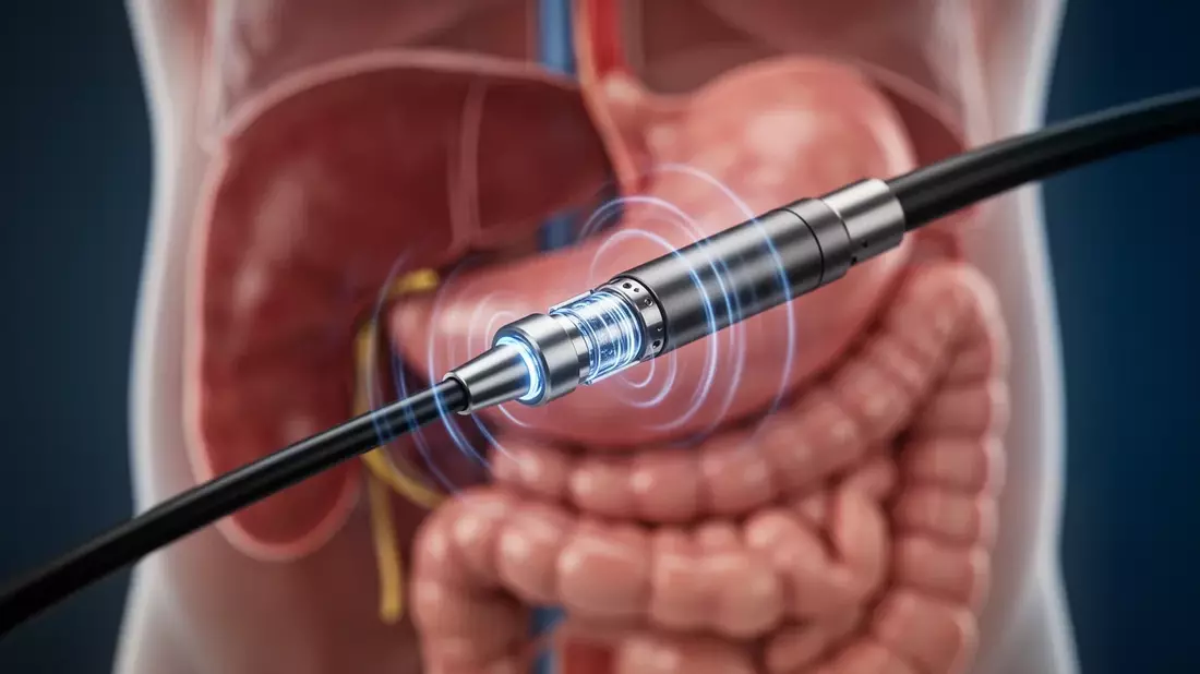 Endoskopischer Ultraschall: Neue Therapie-Plattform mit 82% Tumorkontrolle