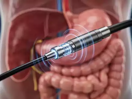 Nahaufnahme der Spitze eines Endoskops mit Ultraschallwandler, das blaue Lichtwellen aussendet, vor verschwommenem anatomischem Hintergrund. - Foto: über boerse-global.de