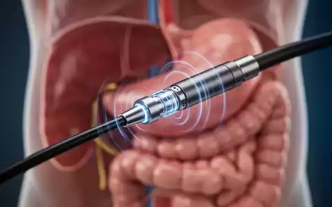 Nahaufnahme der Spitze eines Endoskops mit Ultraschallwandler, das blaue Lichtwellen aussendet, vor verschwommenem anatomischem Hintergrund. - Foto: über boerse-global.de