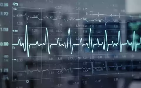 Ein stilisiertes Bild eines Herzmonitors mit unregelmäßigem Rhythmus und überlagerten Zahlen, die Gewichtsverlust darstellen. - Foto: über boerse-global.de