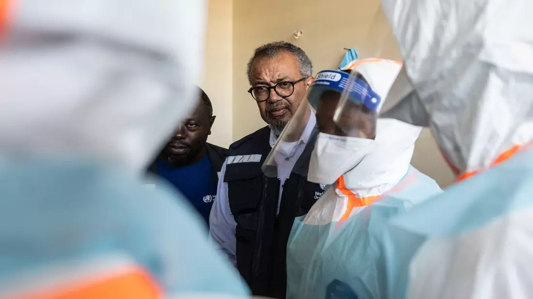 Dem WHO-Chef bereitet die Lage im Kongo größere Sorgen als der einzelne Patient in Frankreich.  - Bild: Moses Sawasawa/AP/dpa