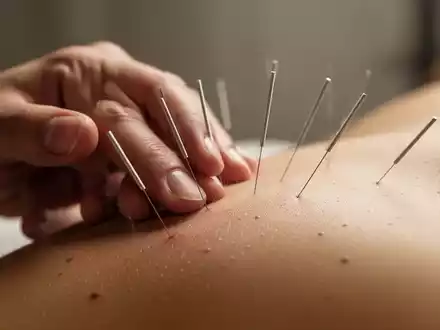 Nahaufnahme einer Hand mit Akupunkturnadeln, die sanft in die Haut eingeführt sind, mit diffusem Licht und einem ruhigen Hintergrund. - Foto: über boerse-global.de