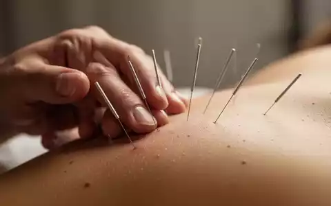 Nahaufnahme einer Hand mit Akupunkturnadeln, die sanft in die Haut eingeführt sind, mit diffusem Licht und einem ruhigen Hintergrund. - Foto: über boerse-global.de
