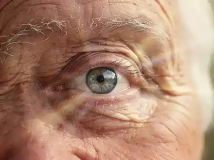 Nahaufnahme eines älteren Auges mit angedeuteter UV-Strahlung, die Alter und Augengesundheit symbolisiert. - Foto: über boerse-global.de