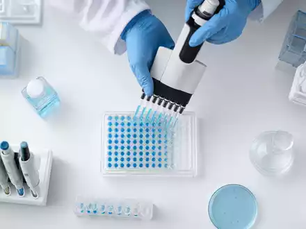 Argenx NL0010832176 Mehrkanal-Pipette befüllt von oben eine blaue 96-Well-Platte im Immunologie-Labor sorgfältig - Foto: THN