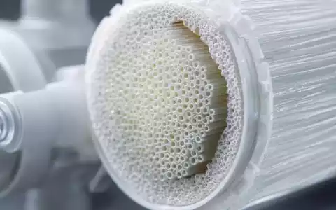 Eine extreme Nahaufnahme einer Hämodialyse-Filterkartusche mit sichtbaren Hohlfasermembranen – das Herzstück der Dialysetechnologie, wie sie Fresenius Medical Care AG (ISIN DE0005785802) entwickelt und vertreibt - Foto: THN