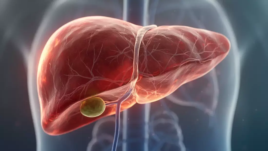 Fettleber als Risiko: Neue Erkenntnisse zu Diagnose und Therapie