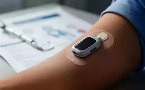 Nahaufnahme eines Glukosesensors auf einem Arm, im Hintergrund verschwommene medizinische Unterlagen, die Technologie und Patientenversorgung symbolisieren. - Foto: über boerse-global.de
