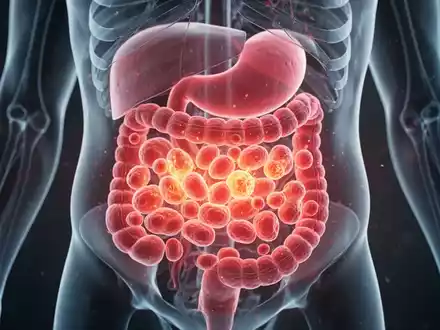 Ein detailliertes Modell eines menschlichen Magens, das entzündete Zellen zeigt, um die autoimmune Gastritis zu veranschaulichen. - Foto: über boerse-global.de