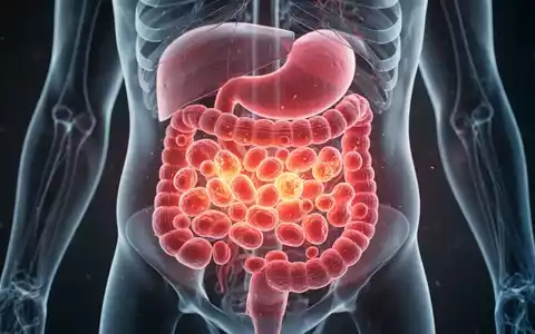 Ein detailliertes Modell eines menschlichen Magens, das entzündete Zellen zeigt, um die autoimmune Gastritis zu veranschaulichen. - Foto: über boerse-global.de