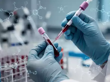 Nahaufnahme von Händen in medizinischen Handschuhen, die ein Blutprobenröhrchen und eine Pipette in einem Labor halten. - Foto: über boerse-global.de
