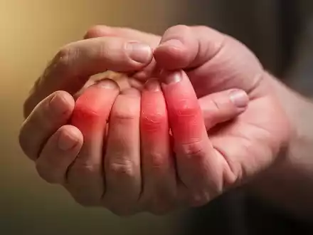 Nahaufnahme einer Hand, die schmerzende Fingergelenke berĂĽhrt, symbolisiert rheumatische Arthritis und chronische Schmerzen. - Foto: ĂĽber boerse-global.de