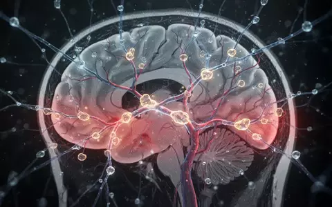 Eine stilisierte Darstellung eines Gehirns mit hervorgehobenen Blutgefäßen und Bereichen verminderter Durchblutung, überlagert von einem leuchtenden neuronalen Netz und subtilen Amyloid-Plaques. - Foto: über boerse-global.de