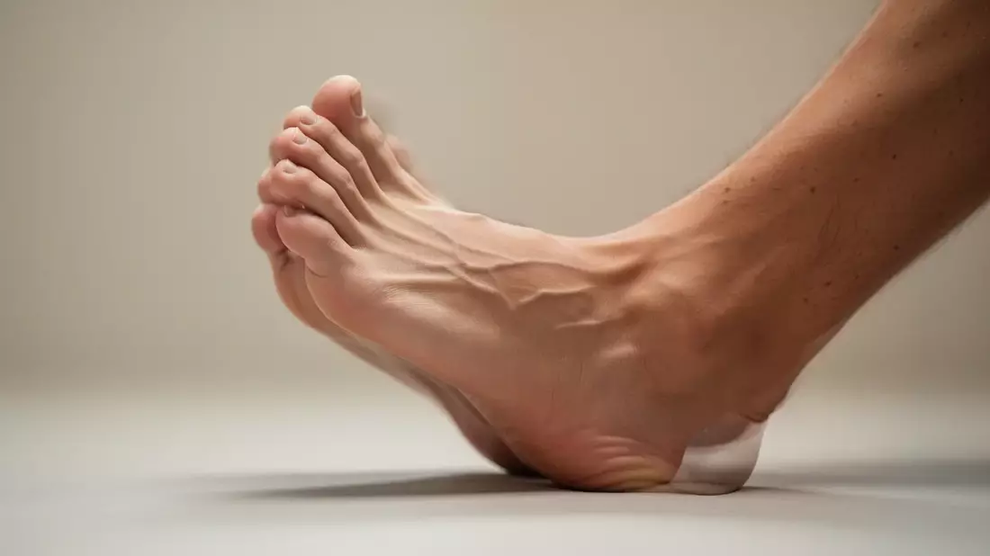 Hallux valgus: Übungen statt OP – neuer Trend in der Orthopädie