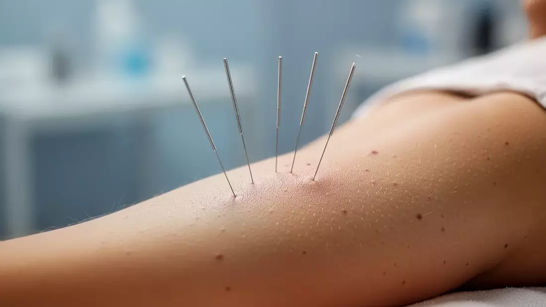 Neurodermitis: TCM und Ziegenmilch als neue Therapieansätze