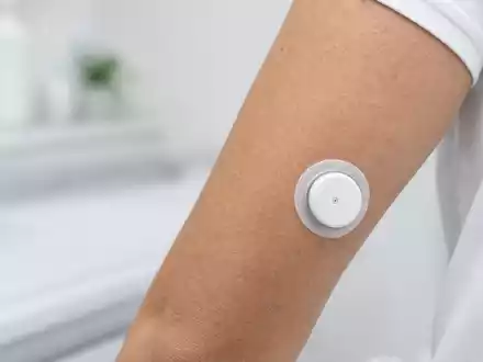 Dexcom Inc. zeigt fotorealistischen CGM-Sensor am Unterarm für Anleger mit ISIN US2521311074 Medizintechnik - Foto: THN